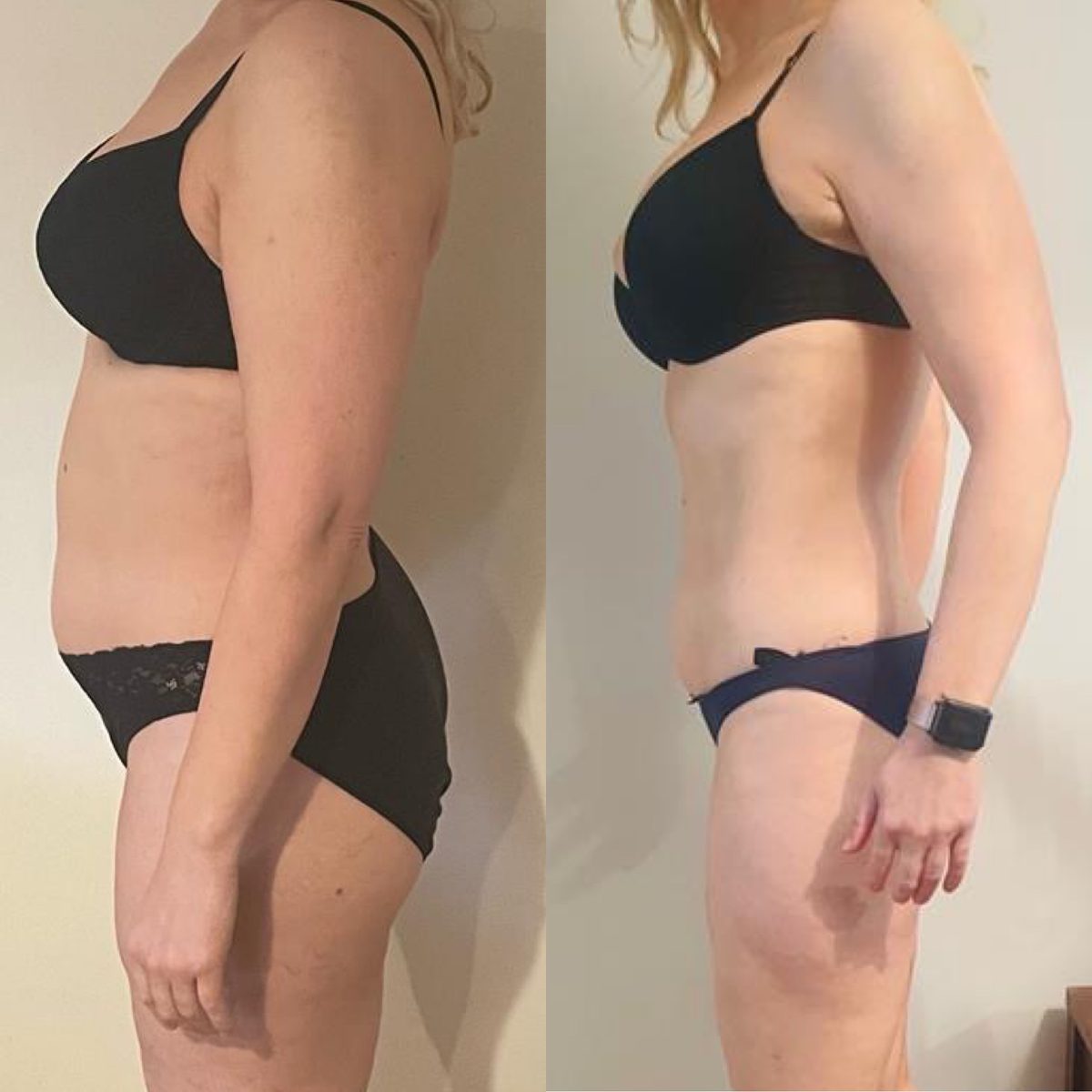 Client transformation